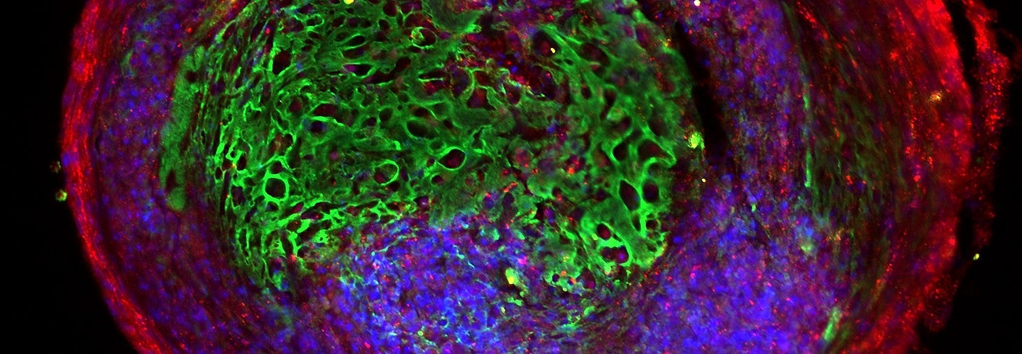 Scientific image in green, purple and red on black showing and organoid scan