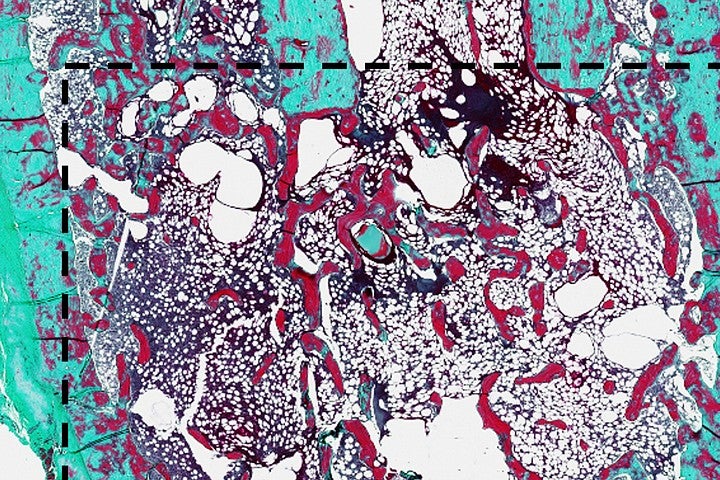 Histological staining in aqua, purple and black