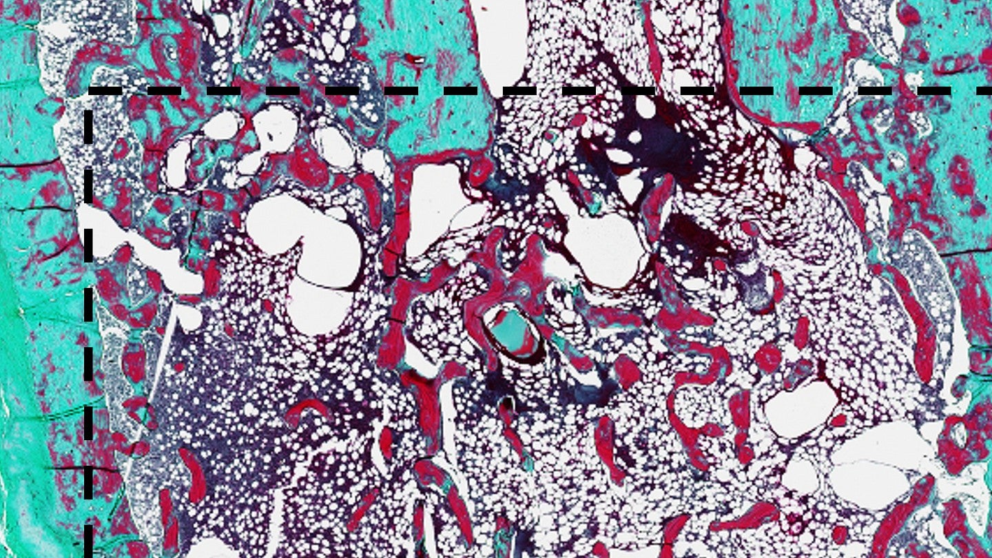 Histological staining with Goldner’s Trichrome of negative control and FK506-treated femurs