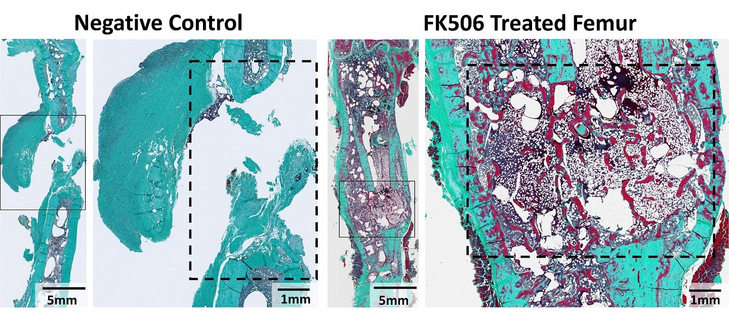 histological staining of negative control and FK506-treated femurs