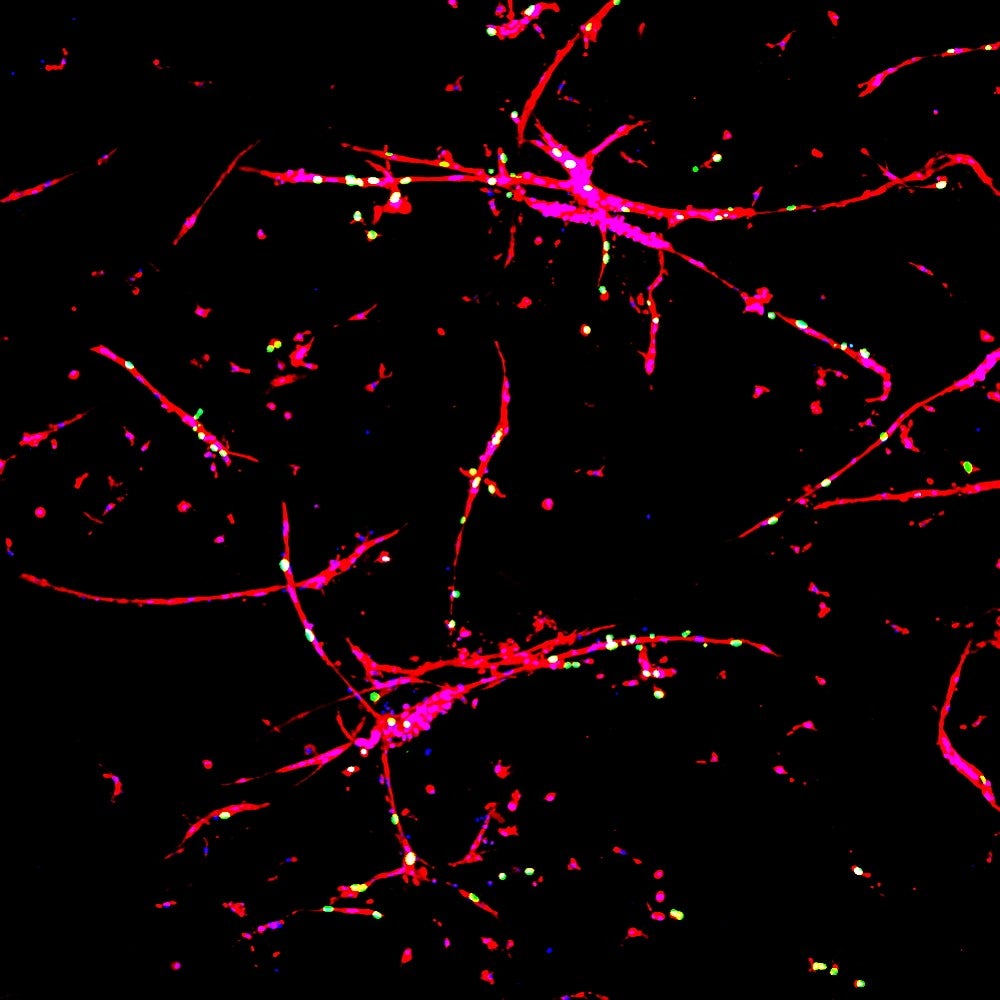 blood vessels grown in a petri dish, in lab. shown as red and pink filaments against a black background. 