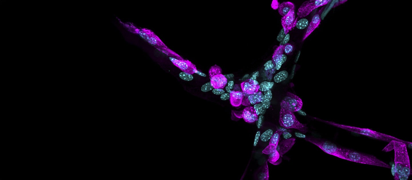 marian hettiaratchi lab science image protein
