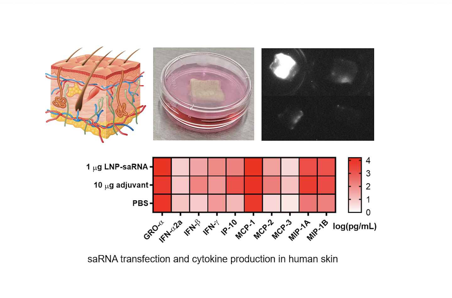 saRNA transfection and cytokine production in human skin from the Peeler lab