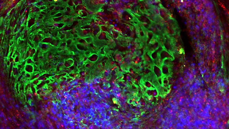 Scientific image in green, purple and red on black showing and organoid scan