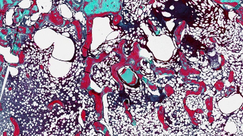 Histological staining with Goldner’s Trichrome of negative control and FK506-treated femurs