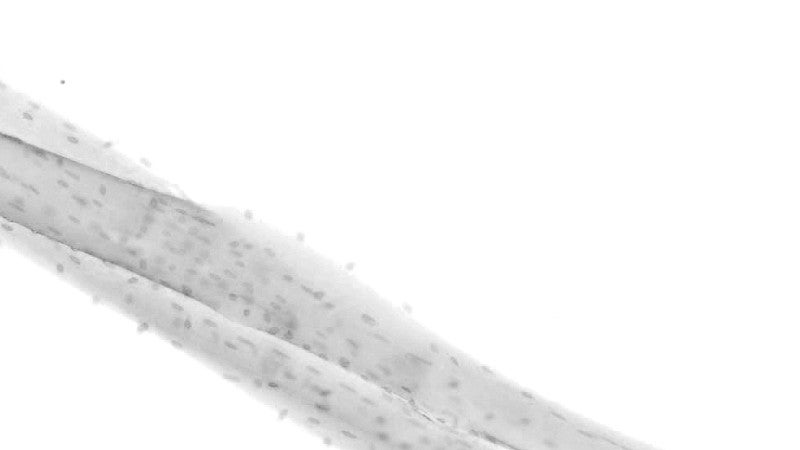 black and white muscle fiber