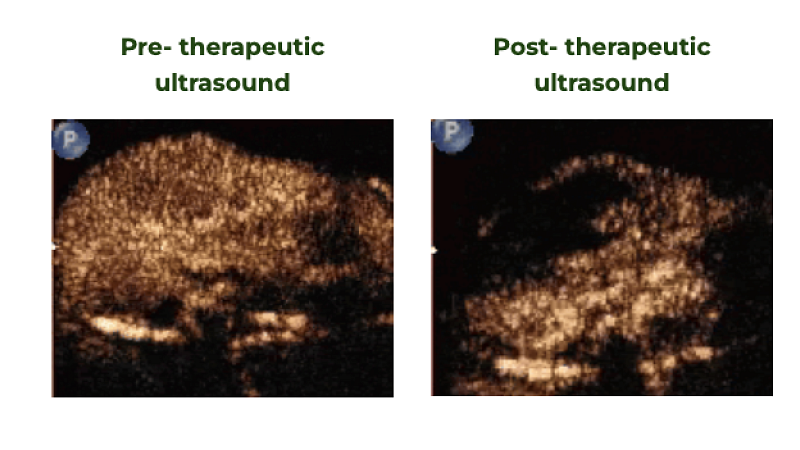 graphical abstract for Ultrasound Imaging of Microbubble Activity during Sonoporation Pulse Sequences
