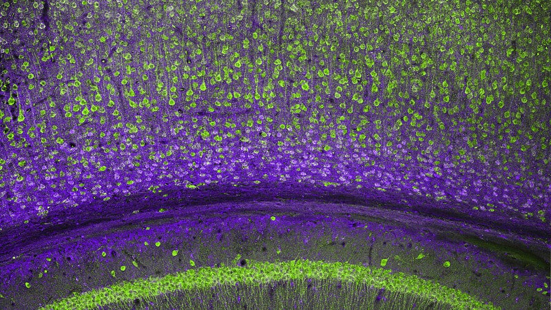 Cerebral cortex and part of the hippocampus under it in a section of a mouse brain, labelled with immunofluorescence and recorded with confocal laser scanning