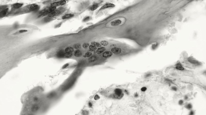 black and white image of osteoclast cells