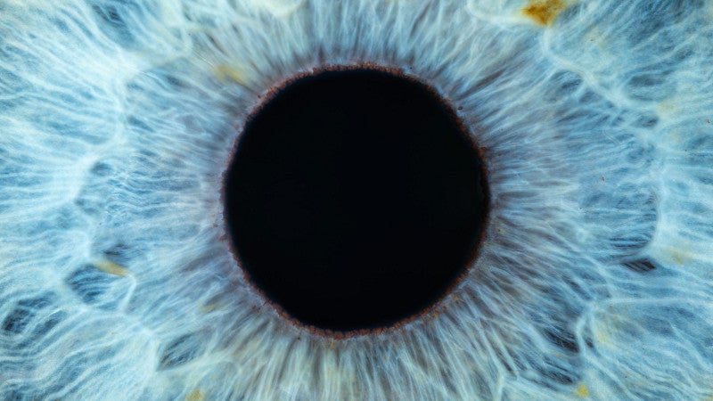 blue cornea
