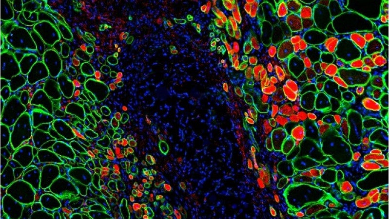 Muscle cells shown in blue and red and green