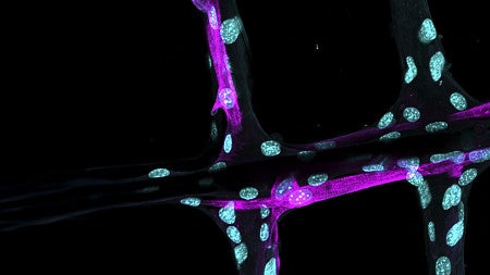 marian hettiaratchi lab science image protein 2