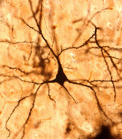 cortex neuron with a golgi stain