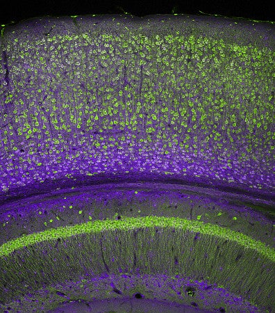 Cerebral cortex and part of the hippocampus under it in a section of a mouse brain, labelled with immunofluorescence and recorded with confocal laser scanning
