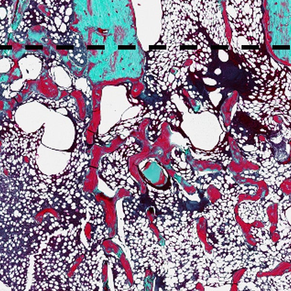 Histological staining with Goldner’s Trichrome of negative control and FK506-treated femurs