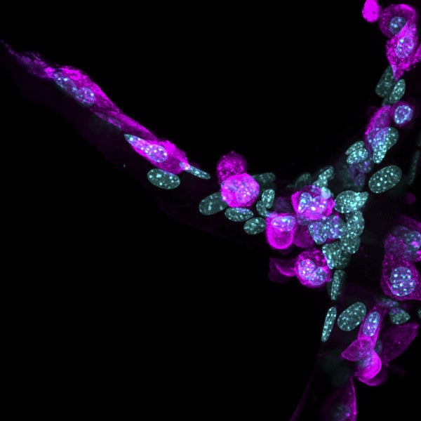 marian hettiaratchi lab science image protein
