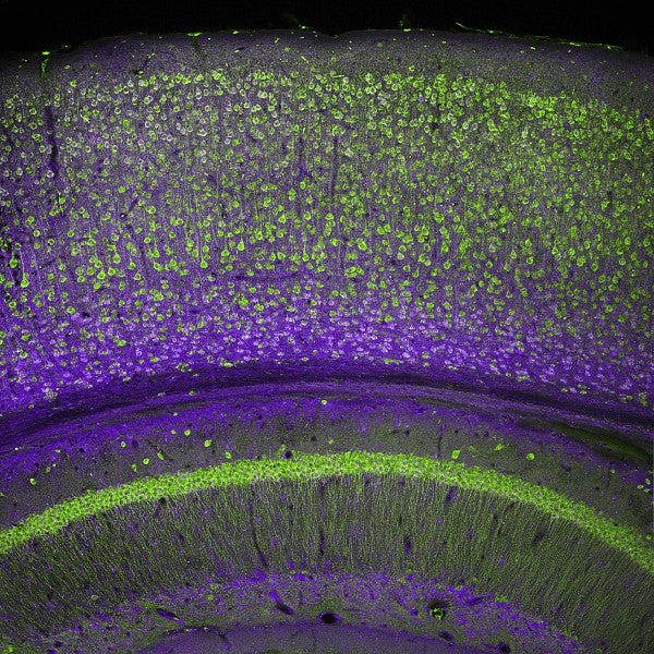 Cerebral cortex and part of the hippocampus under it in a section of a mouse brain, labelled with immunofluorescence and recorded with confocal laser scanning