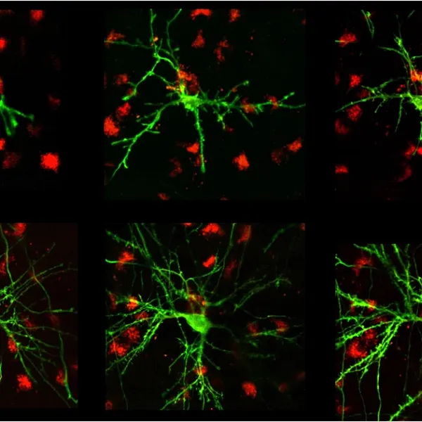 Neuron sections from the Gardner Lab