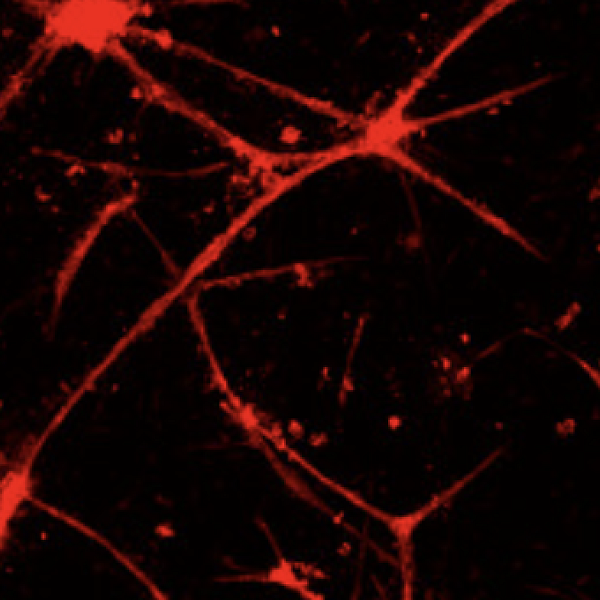 Phased affinity-controlled delivery of vascular endothelial growth factor, fibroblast growth factor-2, and platelet derived growth factor enhances in vitro angiogenesis
