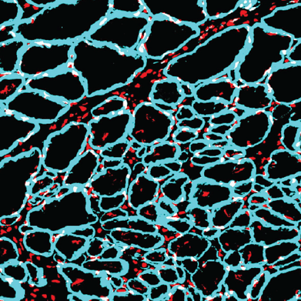 Hydrogel from Nick's Lab