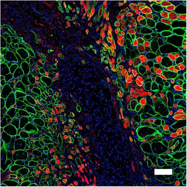 Muscle cells shown in blue and red and green